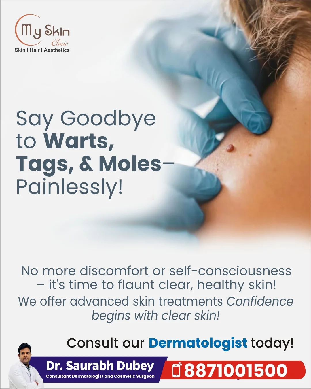 Wart, Skin Tag and Mole Removal in Indore: A Guide to Informed Skin Care